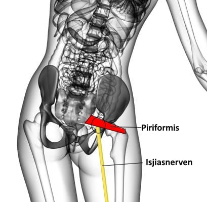 isjias symptomer